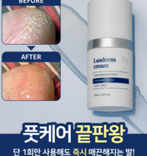 르사덤 발무조메 발각질제거 풋크림 30g